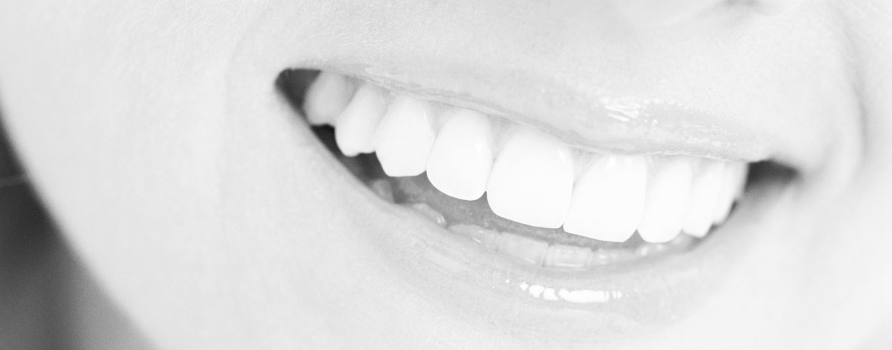 white-teeth-smileBN